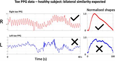 Advancing PPG Signal Quality and Know-How Through Knowledge Translation—From Experts to Student and Researcher